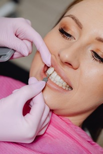 porcelain veneers choosing a porcelain veneer